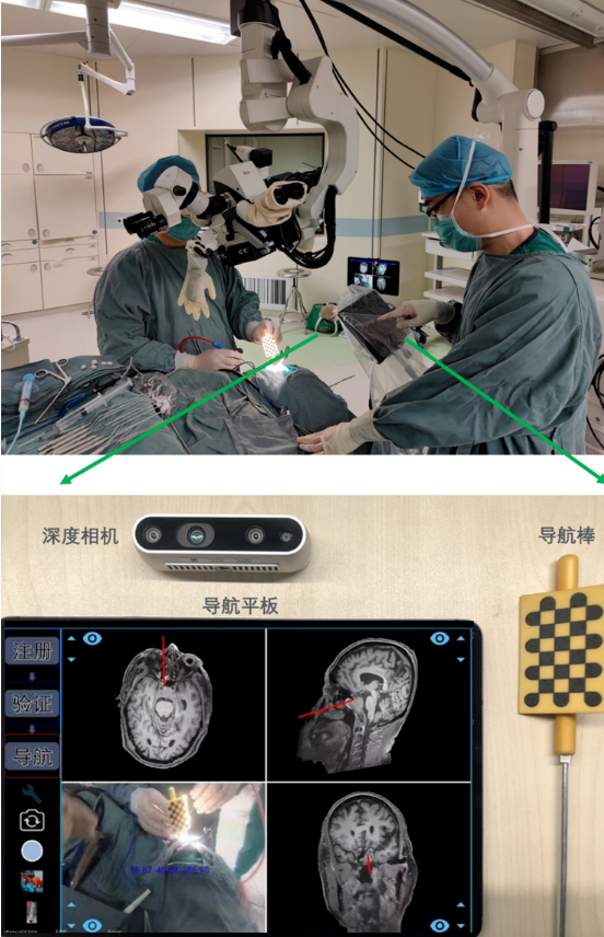 ​北京协和医院联合腾讯发布便携式国产手术导航系统